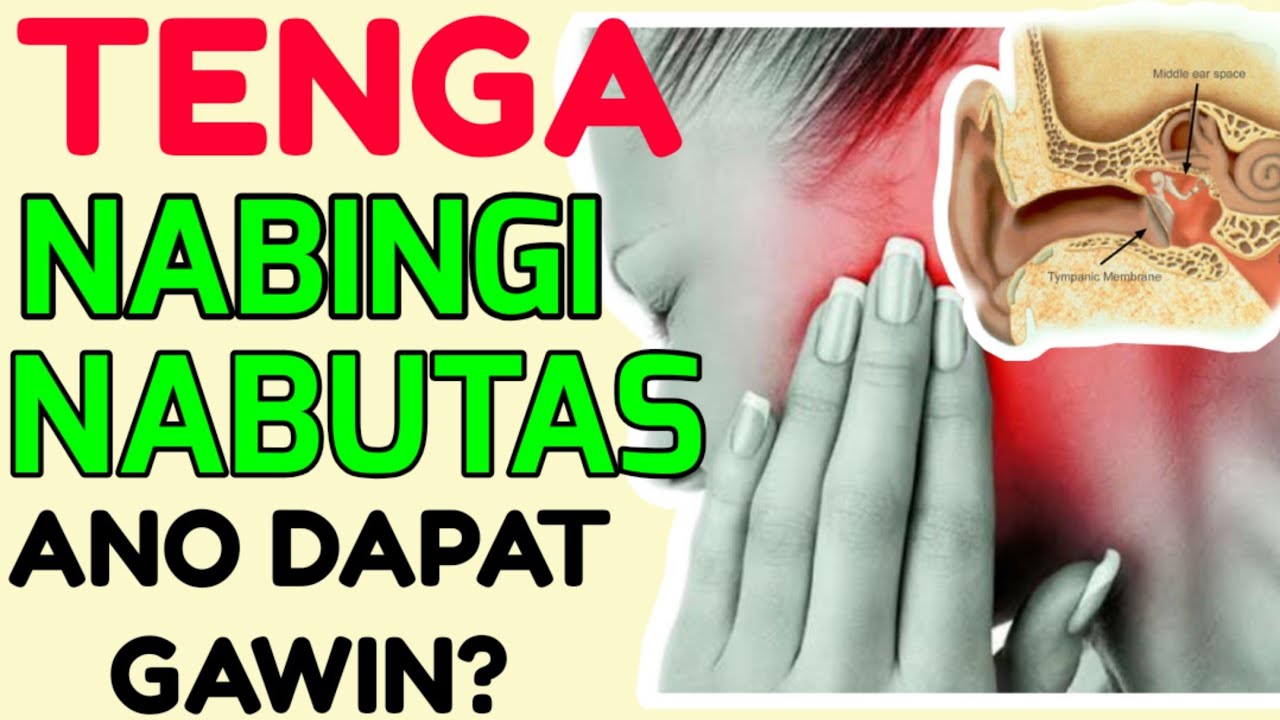 Tenga: Nabutas, Nabingi, Nahilo: Tamang Gamutan - Tips ni Doc Willie Ong #183