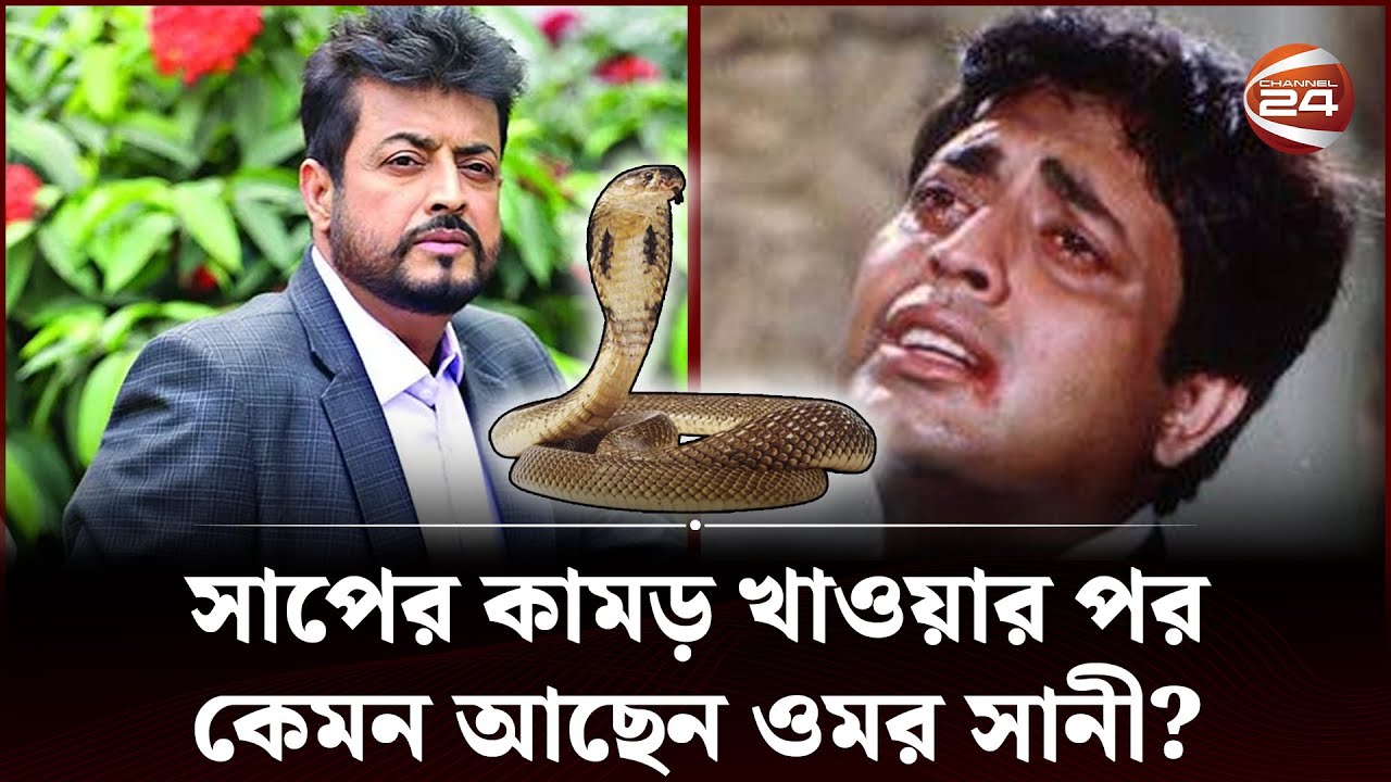 সাপের কামড় খাওয়ার অভিজ্ঞতা শেয়ার করলেন ওমর সানী | Omor Sunny | Channel 24