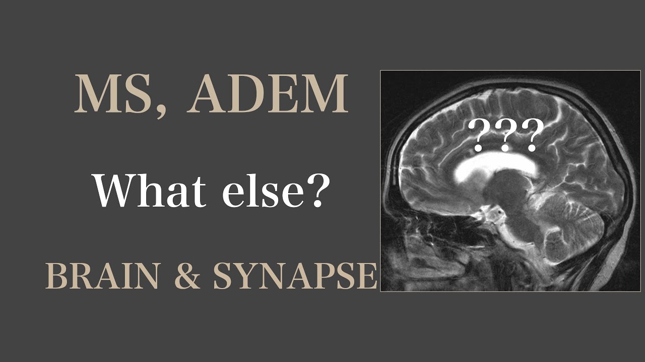MS? ADEM? What else? I Autoimmun Erkrankung I Neuroradiologie I Brain & Synapse