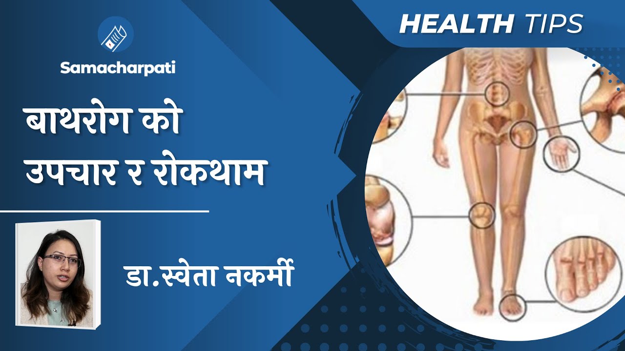Bath Rog Treatment बाथरोग रोकथाम र उपचार Rheumatoid Arthritis | Samacharpati Health Dr Sweta Nakarmi