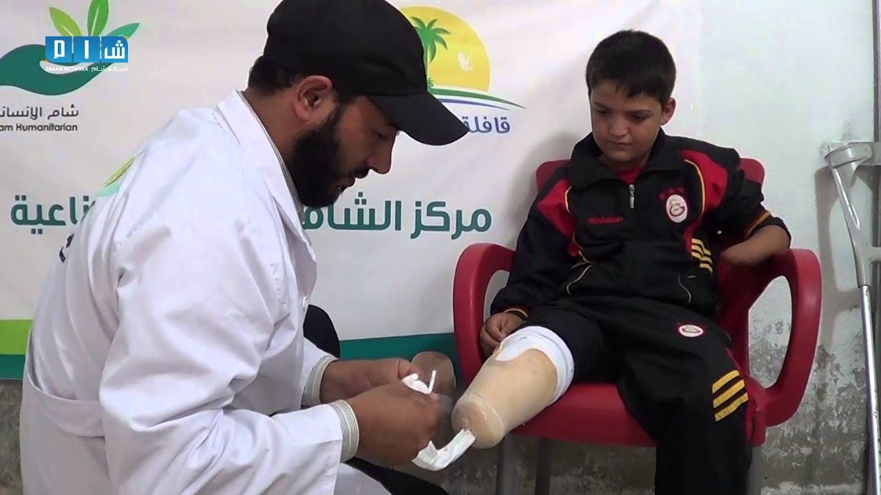 صناعة الأطراف الصناعية تعيد الأمل لفاقدي الأطراف في ريف حماة الشمالي