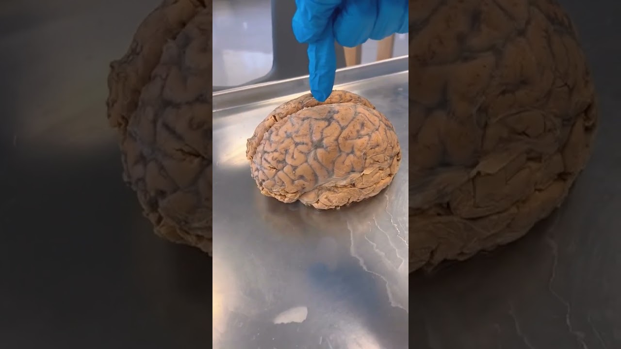Cerebro Humano REAL