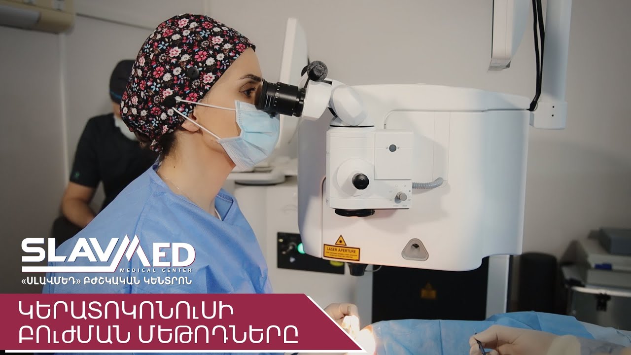 ԿԵՐԱՏՈԿՈՆՈւՍԻ ԲՈւԺՄԱՆ ՄԵԹՈԴՆԵՐԸ