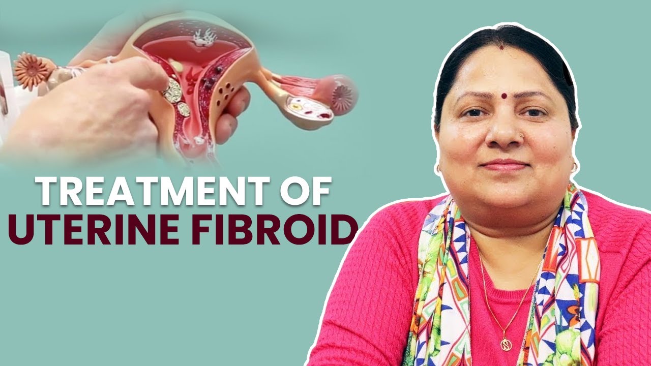 Treatment of Uterine Fibroid by Acupressure