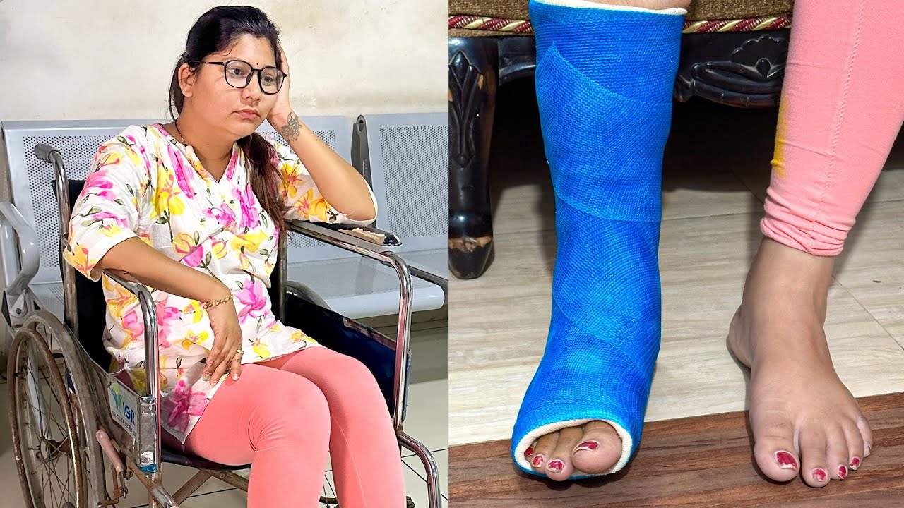 😱જાડુ નો પગ ભાંગી ગયો અને ફેક્ચર આવ્યું😭 - Vlog | Pagal Gujju