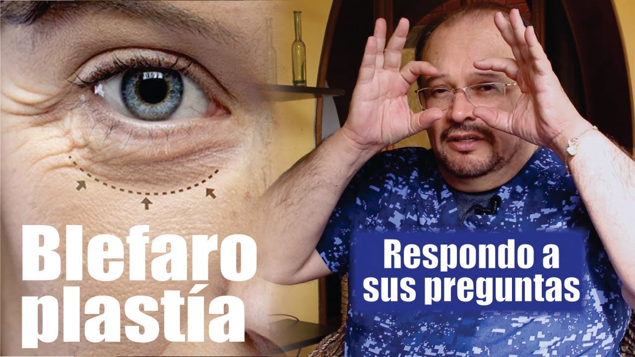 RESPONDO todo sobre BLEFAROPLASTÍA 👀 costo, tipos, post, cuidado, exámenes ⭐ Dr ALBERTO CALVO QUIROZ
