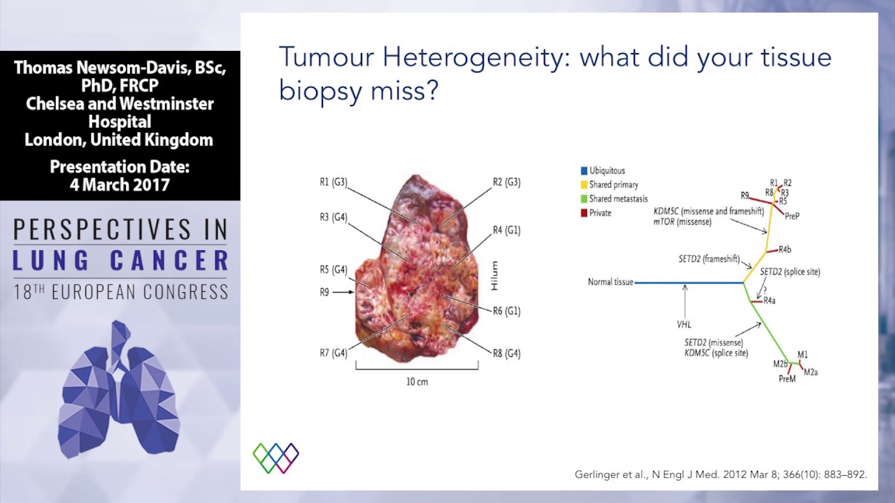 Debate: Liquid biopsy will replace tissue biopsy? - Yes