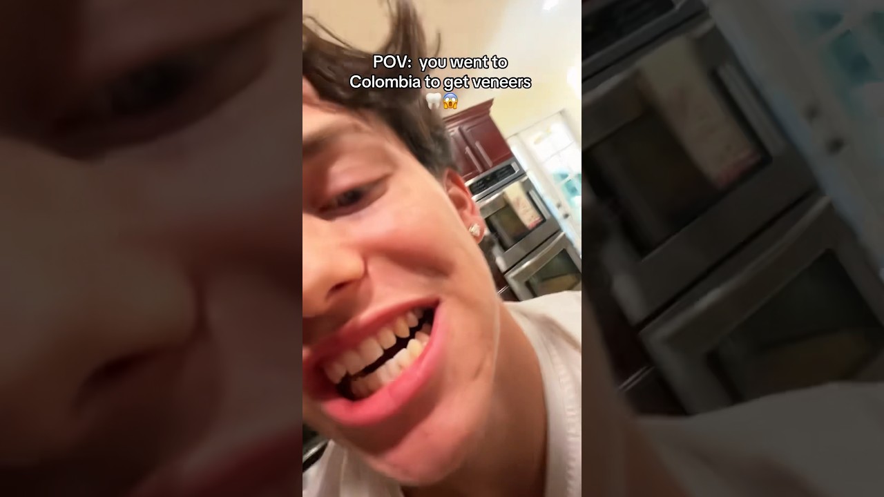 Why His Veneers Are SECRETLY Causing PROBLEMS! 😬🦷