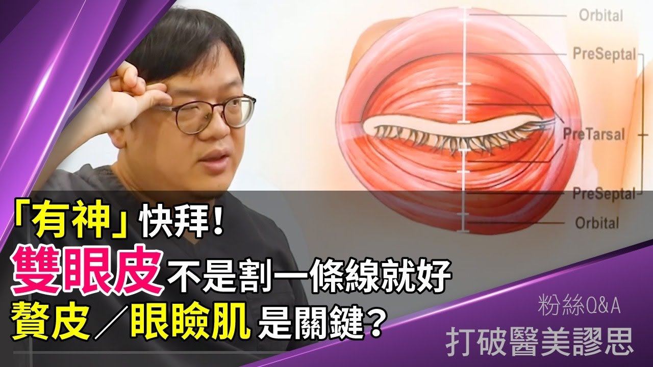 割雙眼皮失敗？  你肯定忽略了這個關鍵！　拯救眼皮下垂的第一步絕對不能走錯...  打破醫美謬思 162-20200811