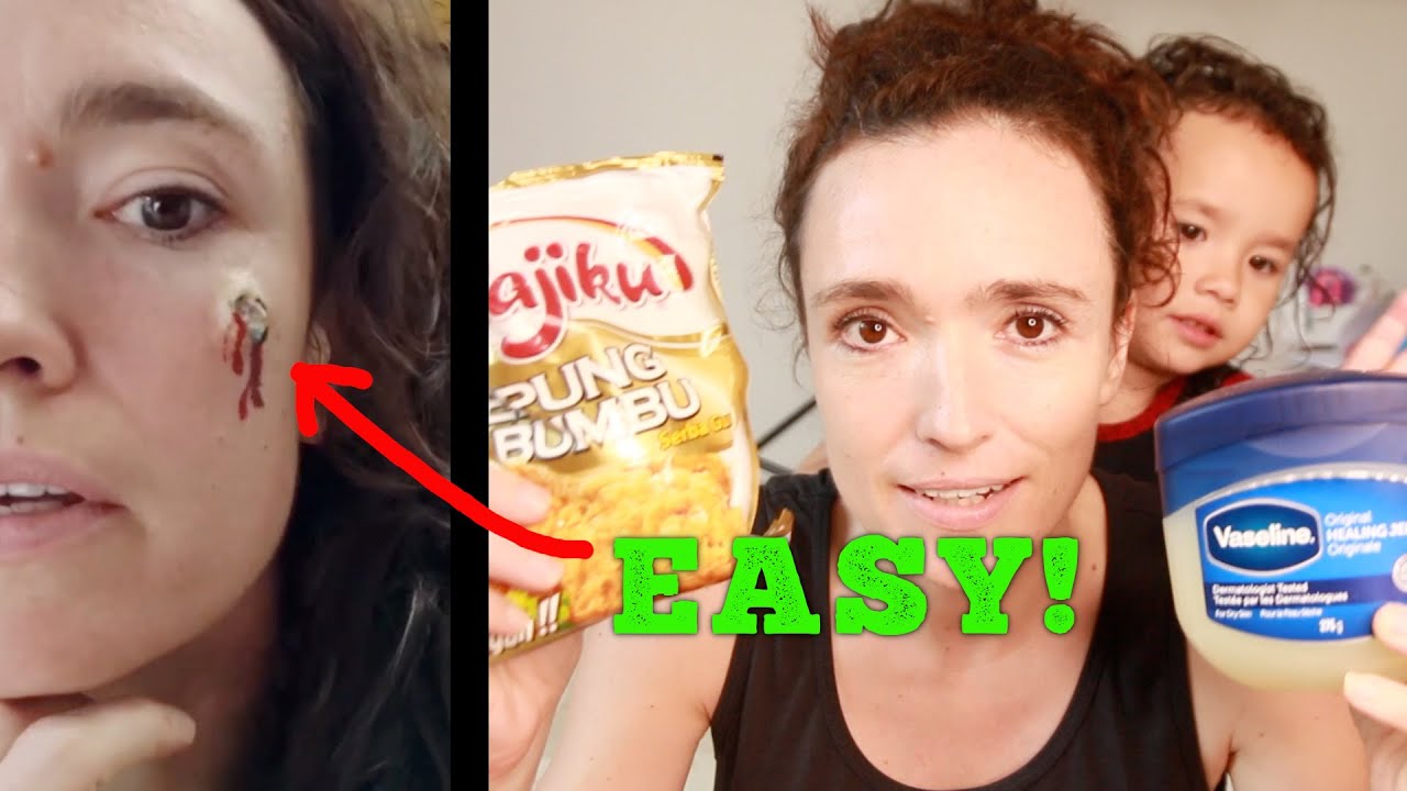 Easy Fake Botfly Tutorial