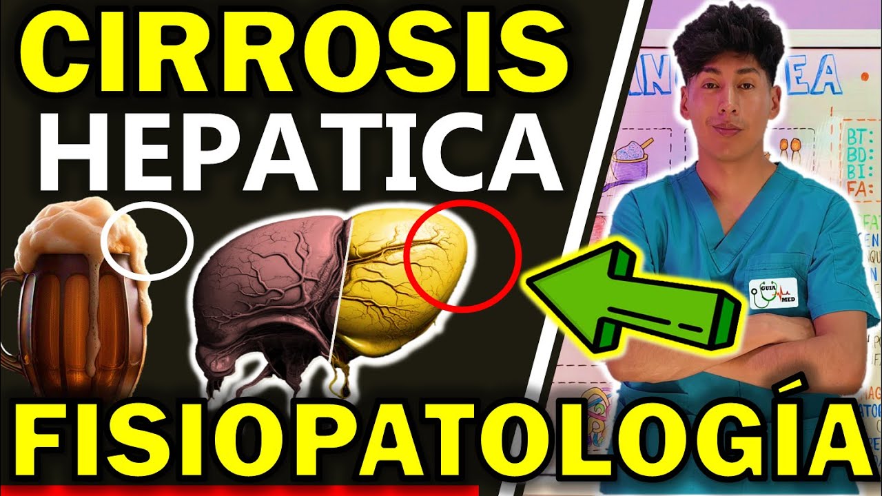 CIRROSIS HEPÁTICA CAUSAS Y FISIOPATOLOGÍA | GuiaMed