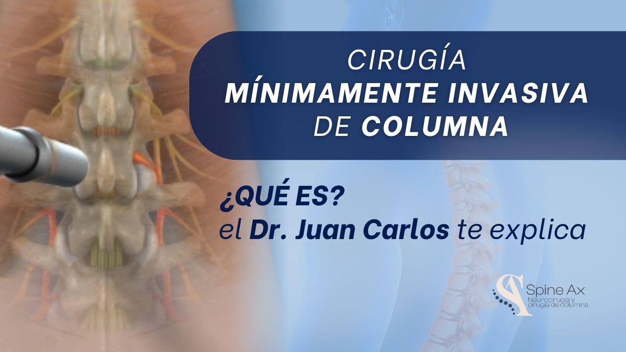 ¿Qué es la Cirugía Mínimamente Invasiva de Columna? Descúbrelo Aquí