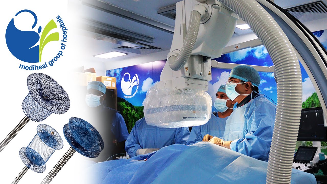 Successful PDA Closure Procedure| Banice Praise, Four Year Old| Dr. Vijay Sinh Patil