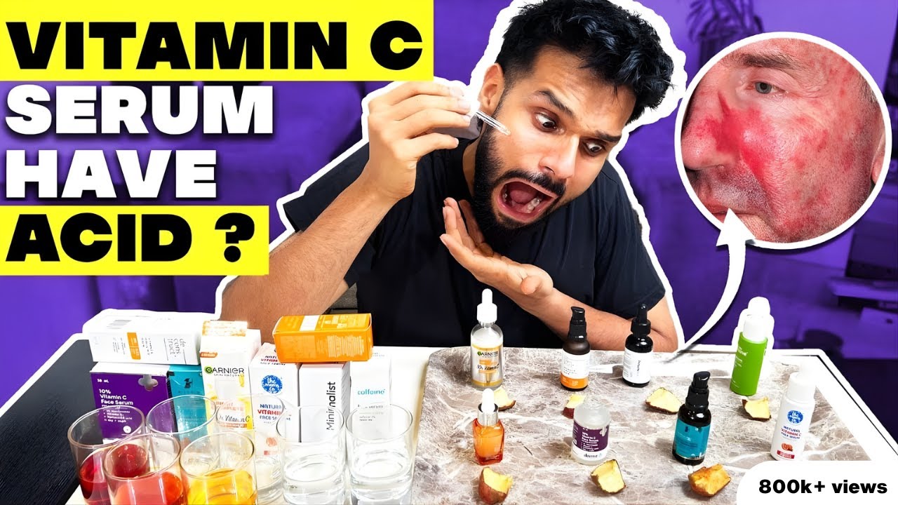 Testing The Best Vitamin C Serum For Indian Skin *Shocking Result* | BeYourBest Skincare San Kalra​