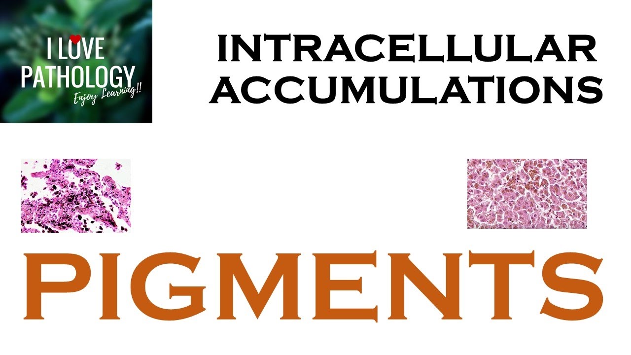 INTRACELLULAR ACCUMULATIONS:  PIGMENTS