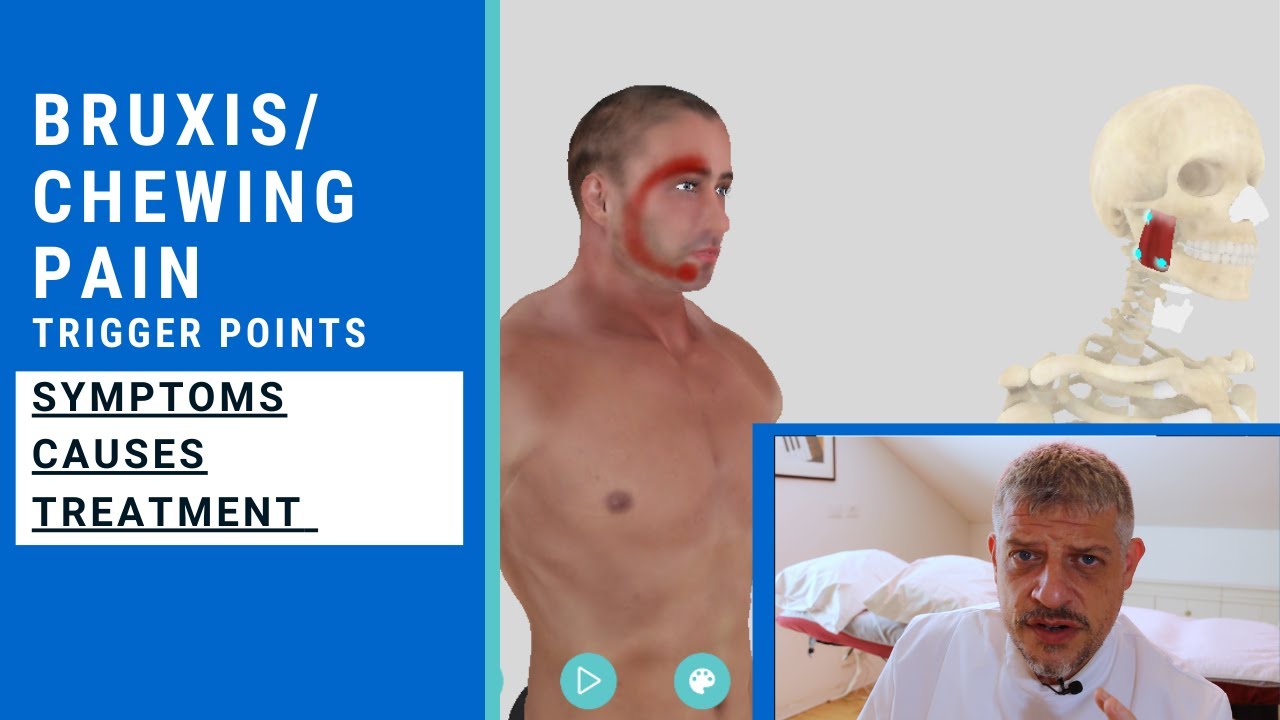 Jaw Pain - Bruxism - Chewing Pain - Trigger Point of the Week