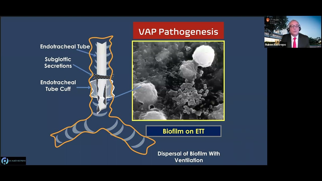 Ventilator Associated Events New Challenges to Well Known Complications