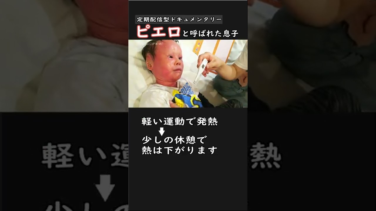 30万人に１人の難病「道化師様魚鱗癬」ピエロと呼ばれた息子シリーズ #Shorts #CBCドキュメンタリー