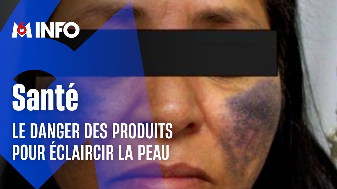 Ces produits pour éclaircir la peau qui font tâche !