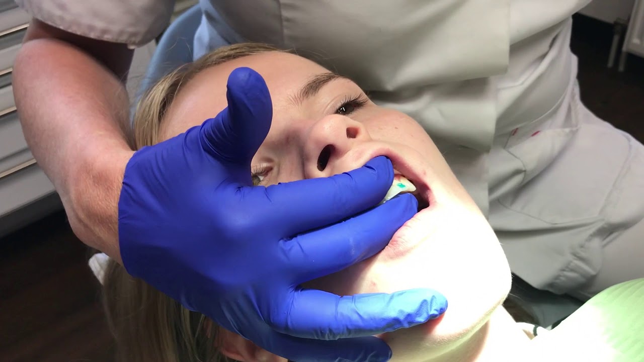 Het leven van een mondhygiënist. #13, Diamant
