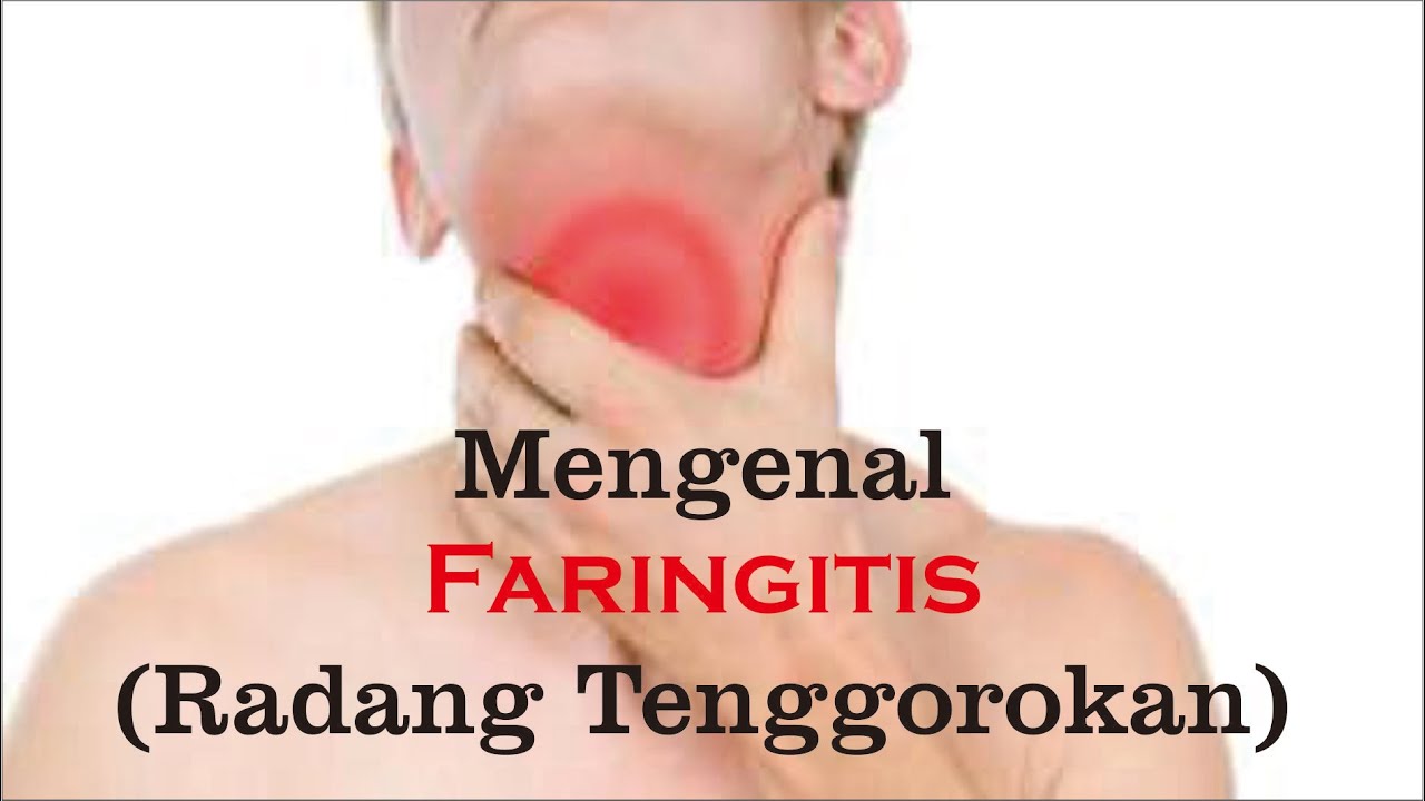 FARINGITIS, Definisi, Gejala, Diagnosis, Penatalaksanaan dan komplikasi