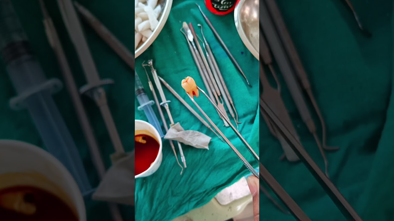 passion #doctor #dentist #jamiamilliaislamia #surgery recovery #surgeon life #bds #mbbs