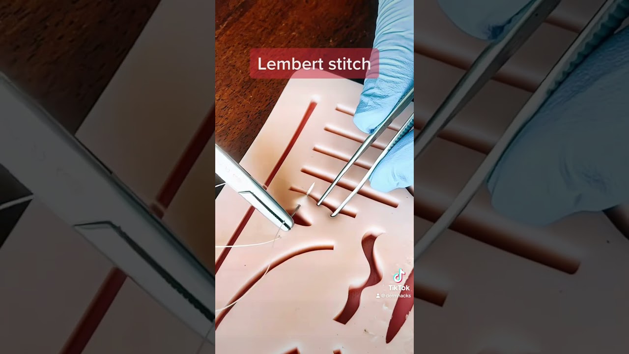 Lembert stitch