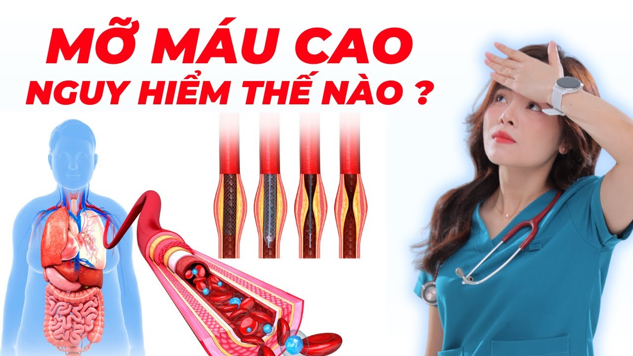 Mỡ máu cao bao lâu thì gây ra đột quỵ? Dr Thuỳ Dung
