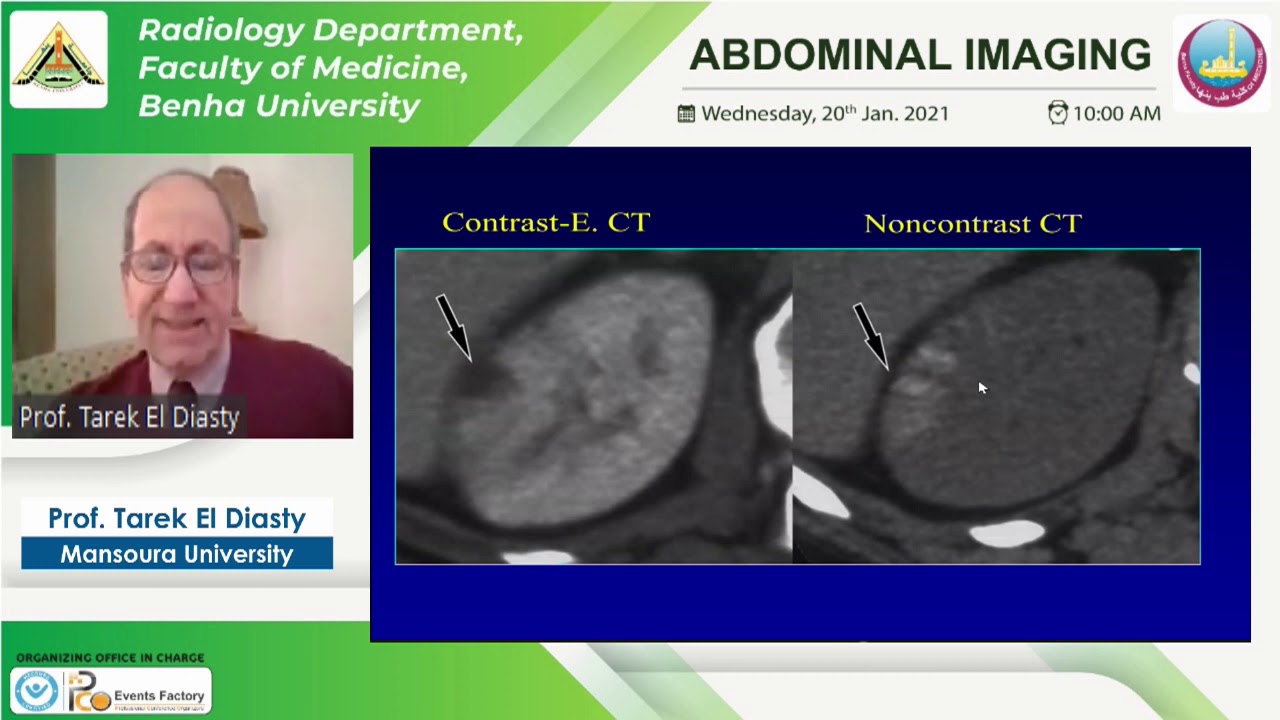 Abdominal Imaging: CT urography