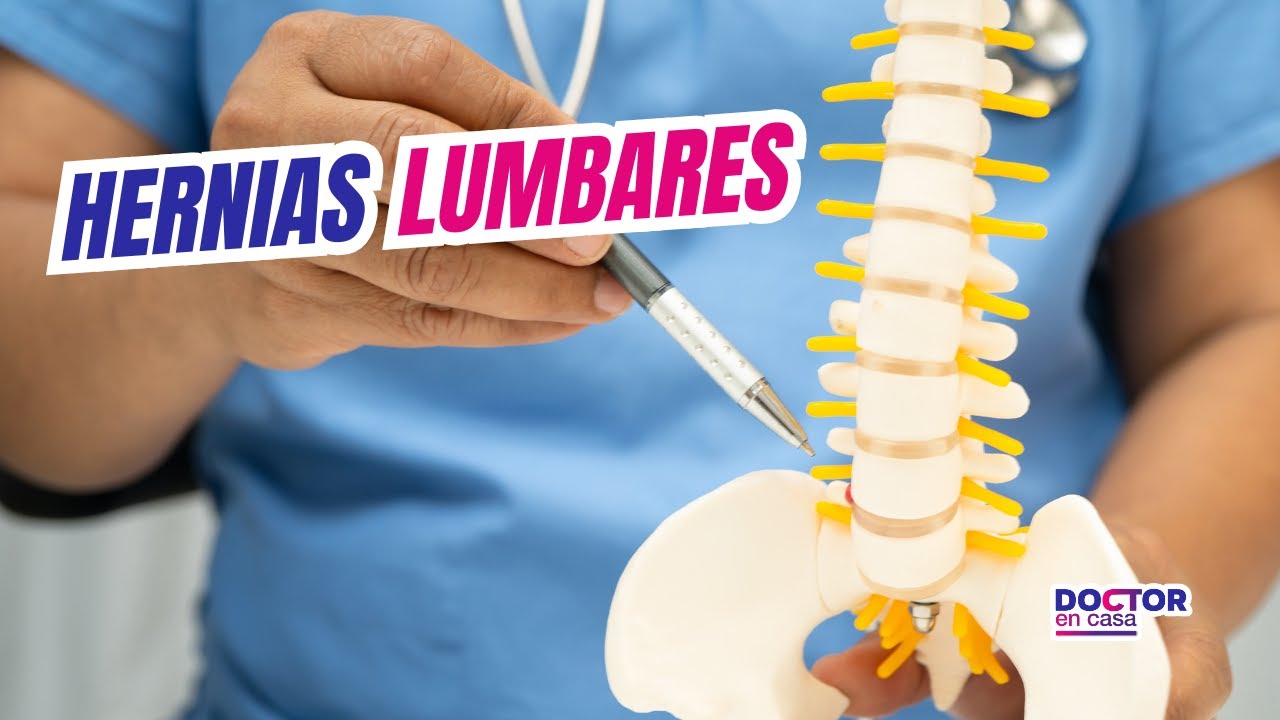 Hernias lumbares