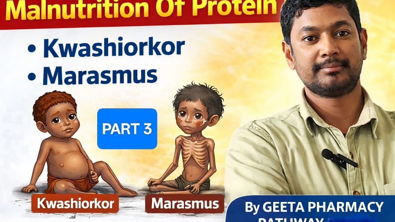 #malnutrition of #protein marasmus  and kwashiorkor Part , 03