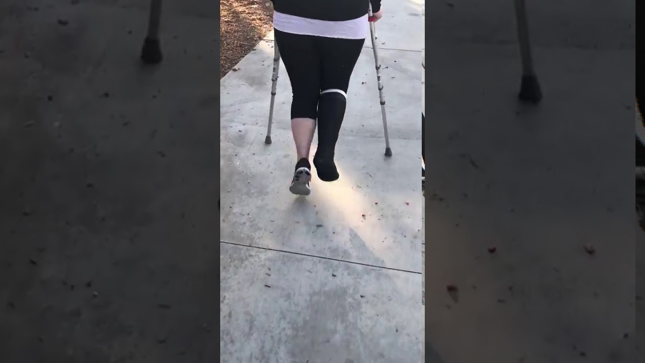 Amy on crutches in a black short leg cast