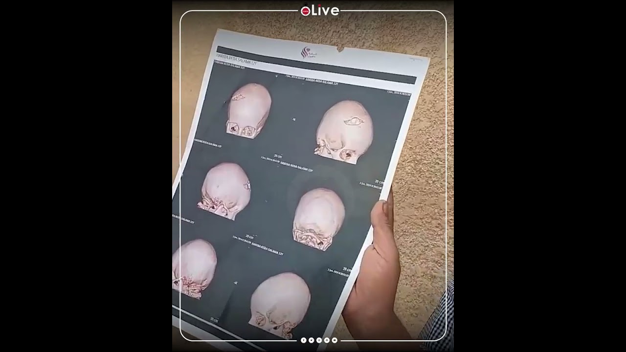 كأن راجل ضارب راجل.. انهيار والد حبيبة ضحية خالها وجدها بكفر الشيخ: دماغ بنتي كانت زي المحفورة