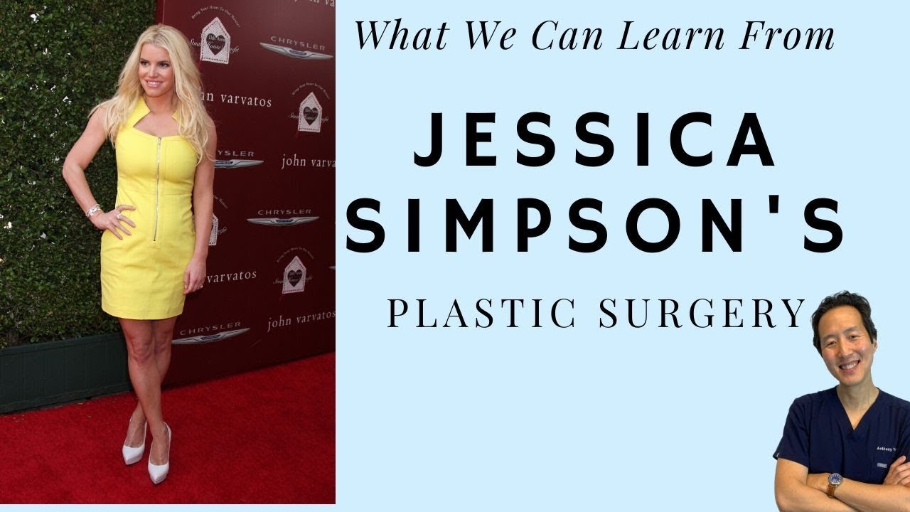 How Did Jessica Simpson Get Her Figure Back? Her Plastic Surgery - Dr. Anthony Youn