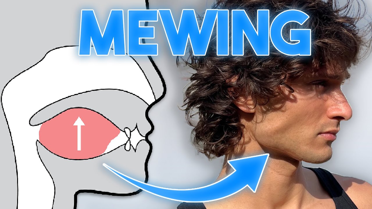 O que é Mewing? (Realmente funciona?)