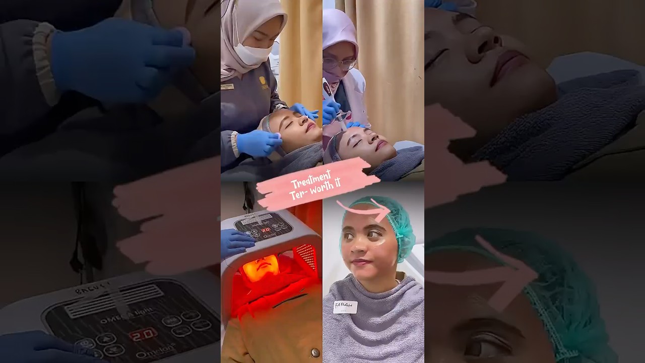 #prossi #klinikestetika #klinikkecantikan #treatment #skinbooster #glowingskin #perawatanwajah #fyp