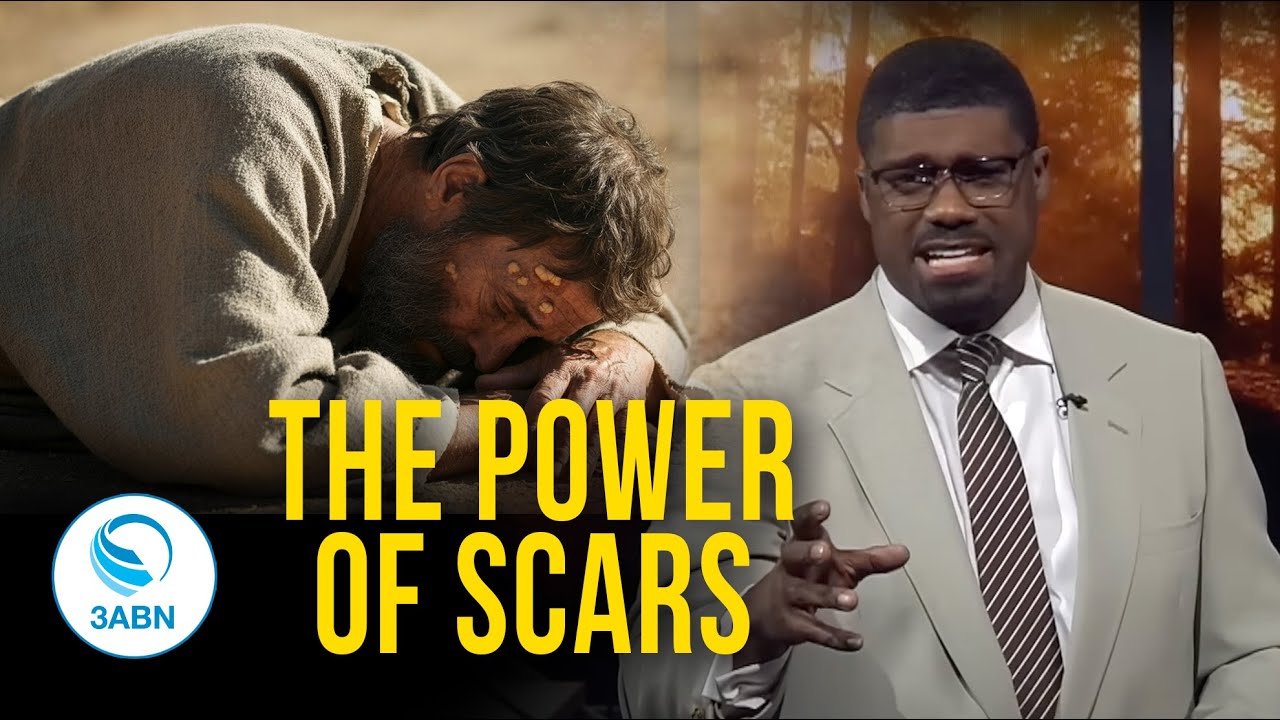 The Blessing in the Bruise | 3ABN Worship Hour