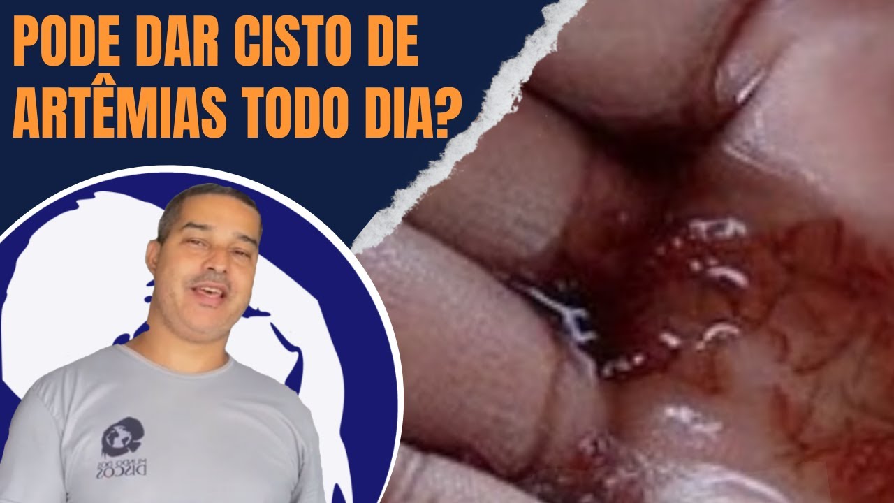 PODE DAR ARTÊMIAS TODO DIAS PARA OS PEIXES?