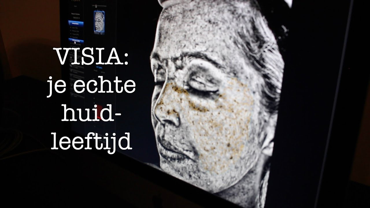 VISIA: je echte huidleeftijd | FURROW.NL