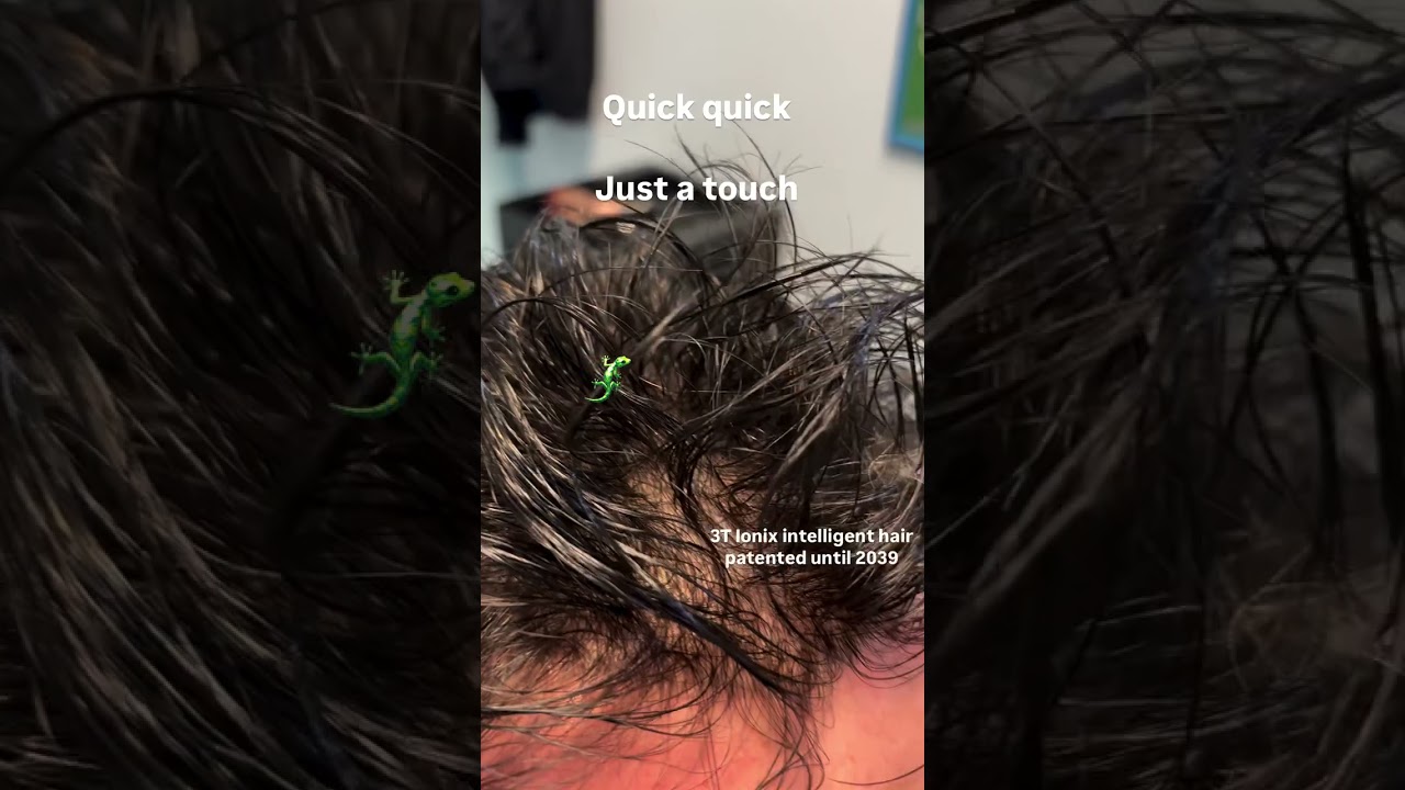 Alopecia areata: La tecnologia 3T Ionix Capelli Intelligenti &egrave; nata per semplificarti la vita