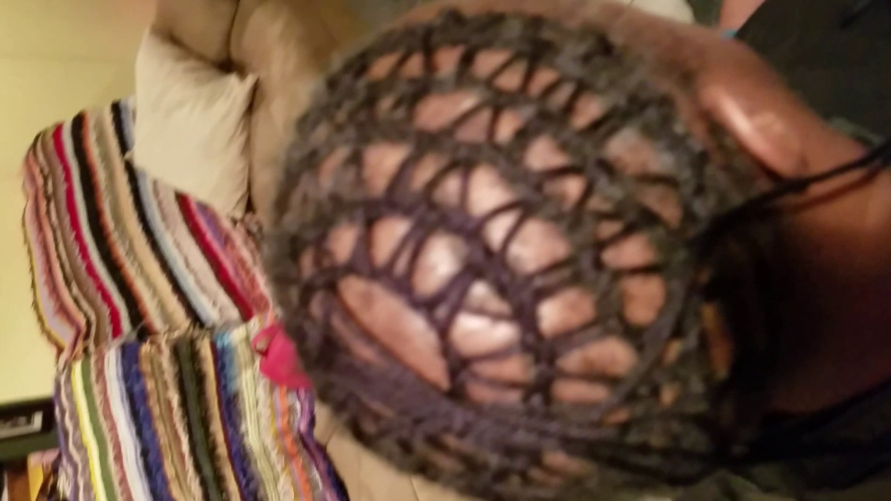 Soft Skull  Hair Restoration