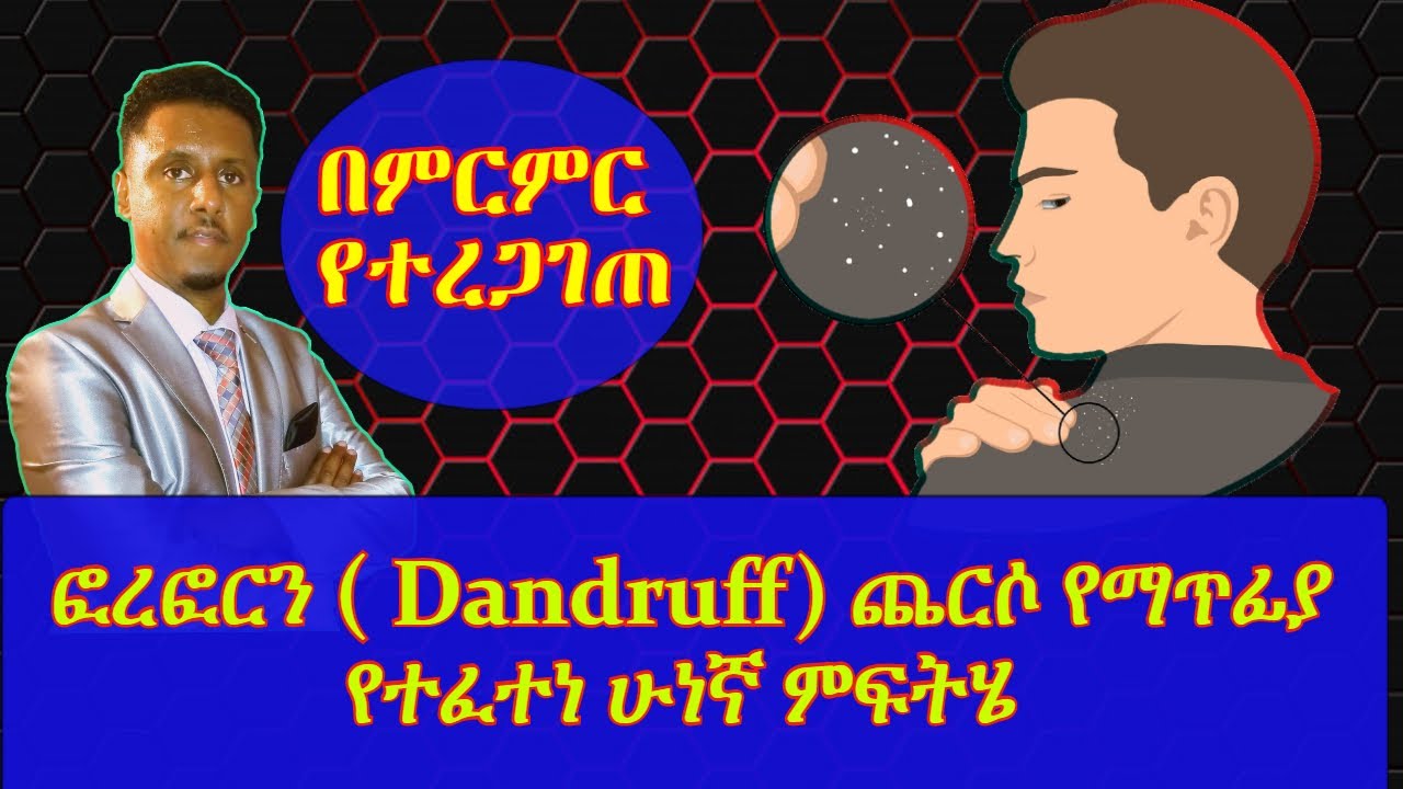 ETHIOPIA | ፎረፎርን ( Dandruff) ጨርሶ የማጥፊያ የተፈተነ ሁነኛ ምፍትሄ