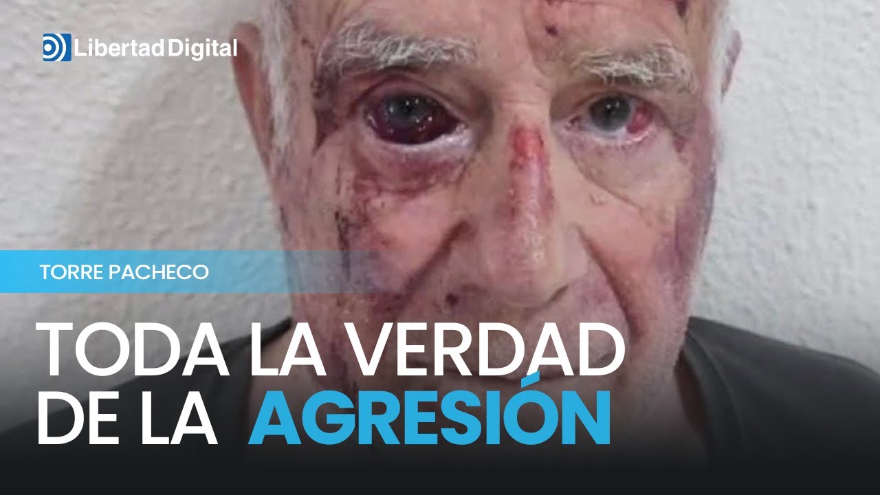 Toda la verdad de la agresión al anciano de Torre Pacheco