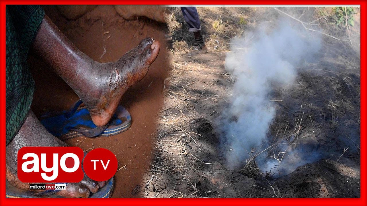 MOTO WAAJABU WAIBUKA ROMBO, WATU WANNE WAUNGUZWA MIGUU 