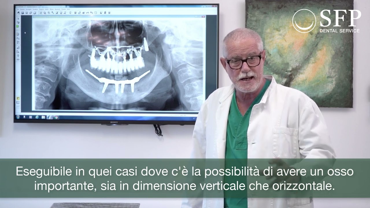 Quali tecniche implantari puoi trovare da SFP Dental Service