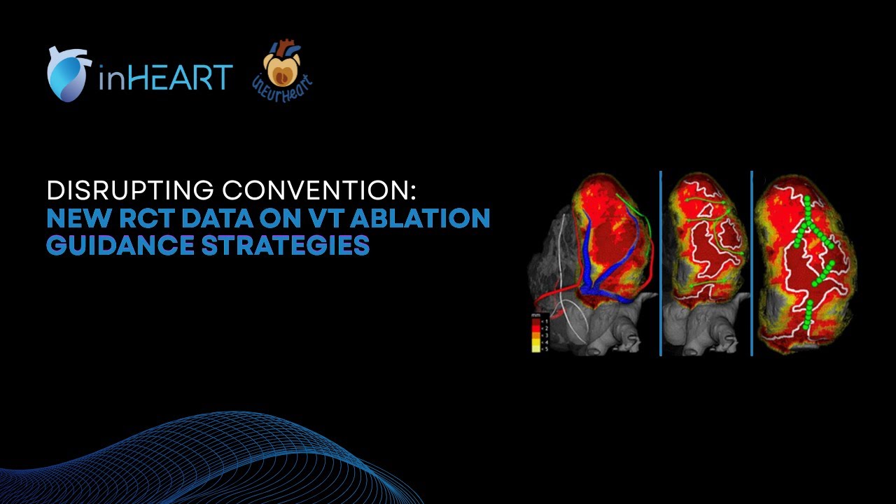 Disrupting Convention: New RCT Data on VT Ablation Guidance Strategies - Webinar