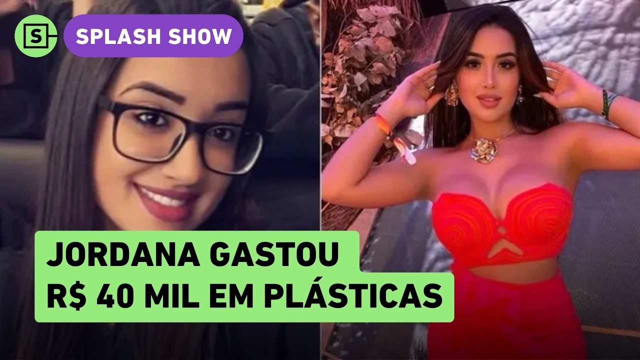Jordana diz que gastou R$ 40 mil em plásticas, mas boca é natural; veja antes e depois