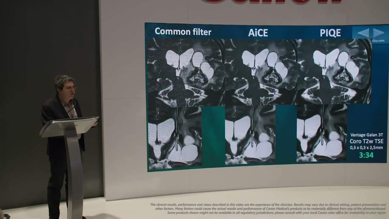 RSNA 2024 Presentation - Julien Savatovsky, MD
