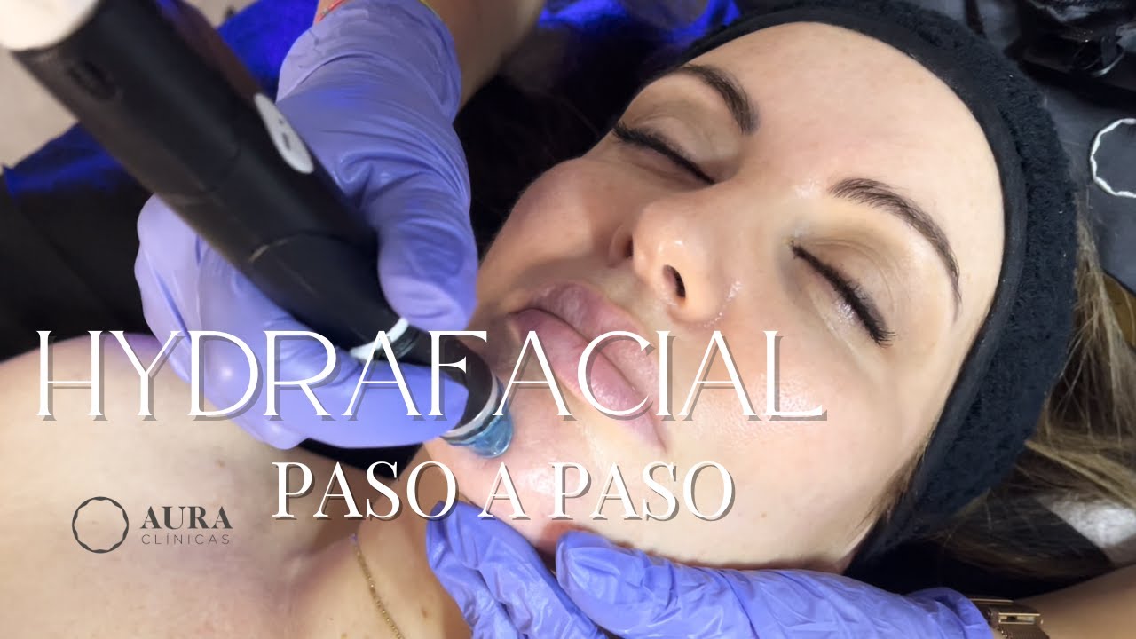 Hydrafacial: El Secreto para una Piel Radiante y Sin Imperfecciones - Beneficios y Resultados