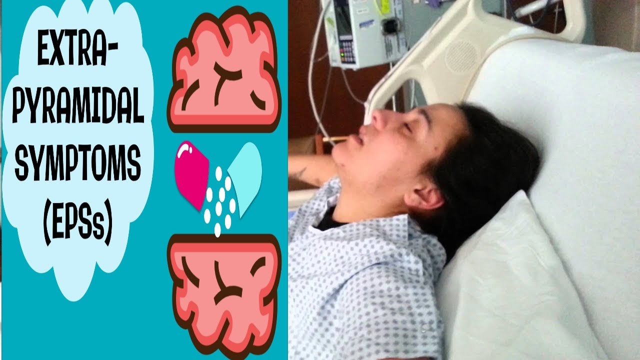 Acute Dystonic Reaction from metoclopramide